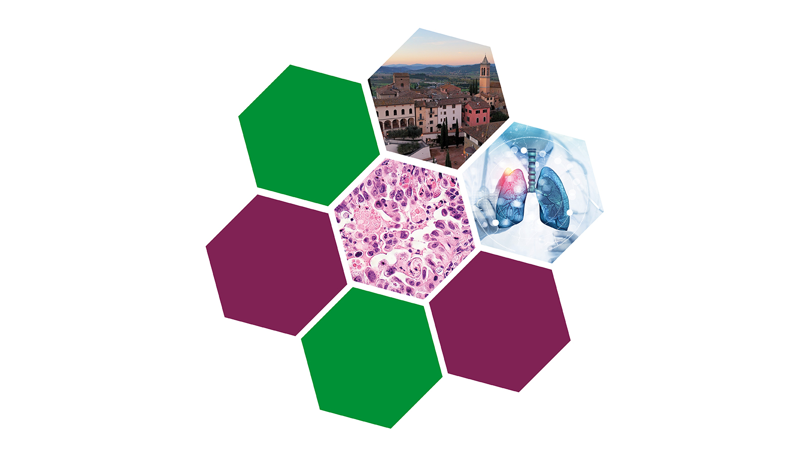 Comunicare il carcinoma del polmone: viaggio dalla diagnosi alla malattia avanzata