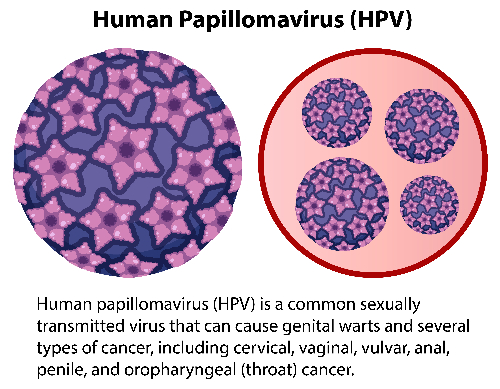Papillomavirus umani e tumori
