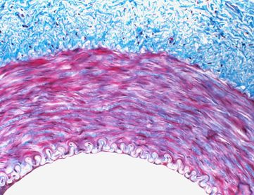 Ipertensione arteriosa polmonare: il nuovo impegno di Janssen nelle malattie rare